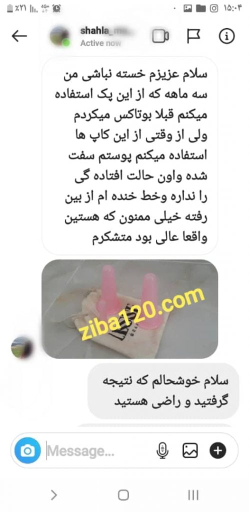 پیام رضایت مشتری زیبا۱۲۰ درباره تجربه استفاده از بادکش صورت