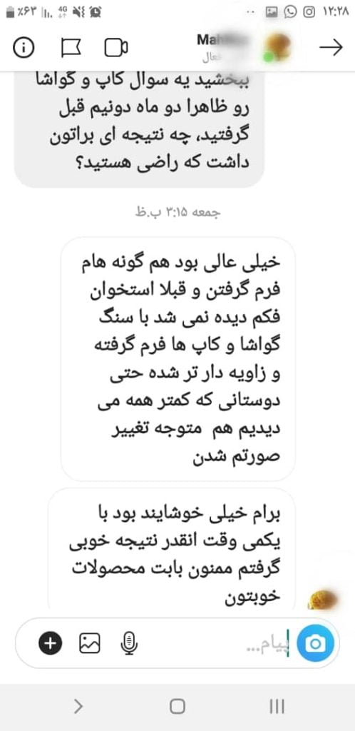 پیام رضایت مشتری زیبا۱۲۰ درباره تجربه استفاده از بادکش صورت